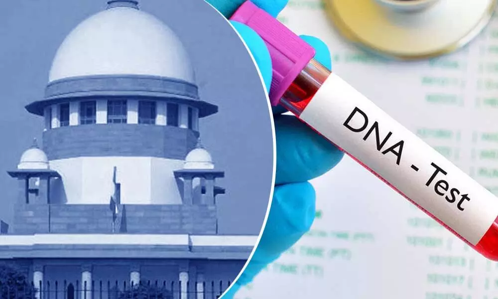 SC orders 84-year-old rape accused to undergo DNA test