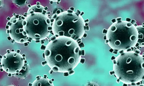 Representational pic