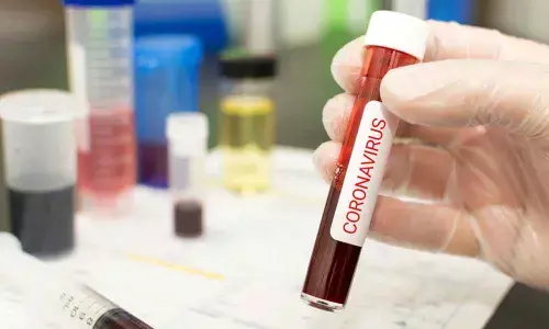 Nellore reports 702 fresh Coronavirus Positive cases