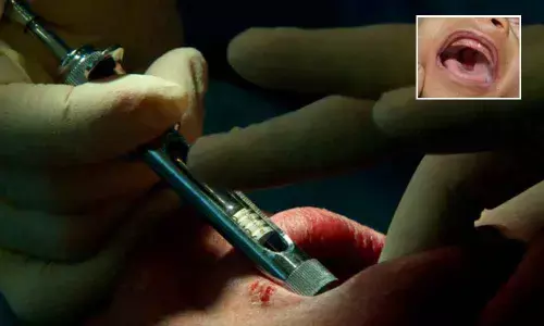 Infant treated for cleft-palate at SRM Dental Hospital