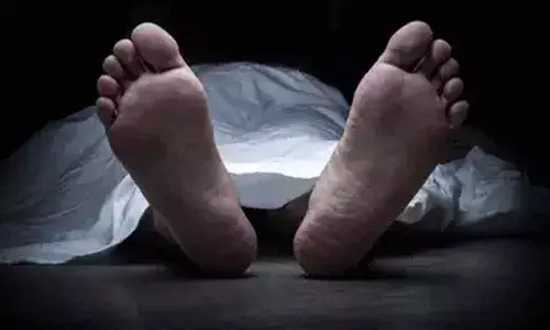 Representational Pic