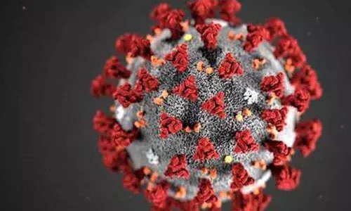 Representational Pic