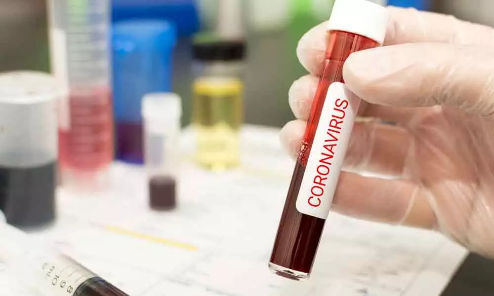 TRS MLA Ramalinga Reddys family tests positive for coronavirus