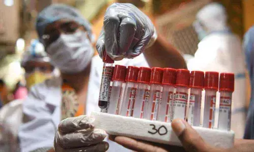 8,012 new Corona cases reported in Andhra Pradesh