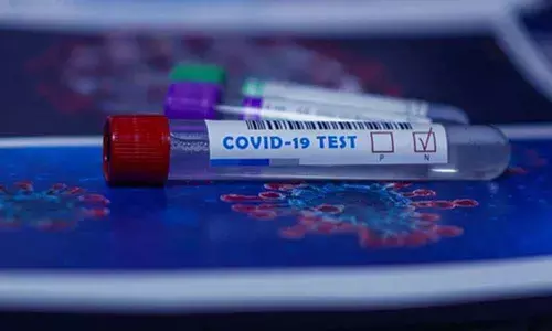 Now, feed Specimen Referral Form ID and get your Corona test result online in Karnataka