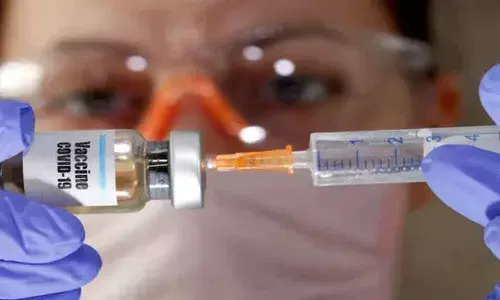 Representational Pic