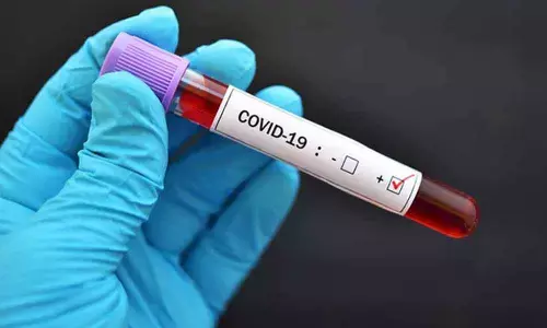 Bengaluru’s Corona positivity rate at 15.55%