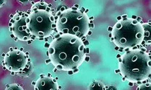 Representational Pic