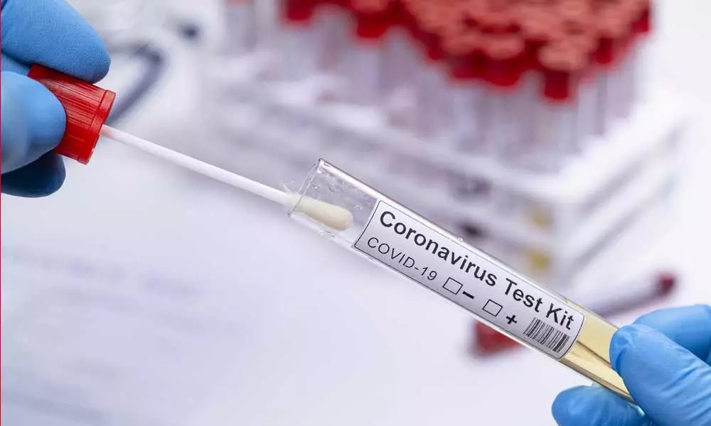Two more YSRCP MLAs tested positive for coronavirus in Andhra Pradesh
