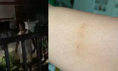 Hyderabad: Serilingampally Corporator Nagendra Yadav Assaults Woman