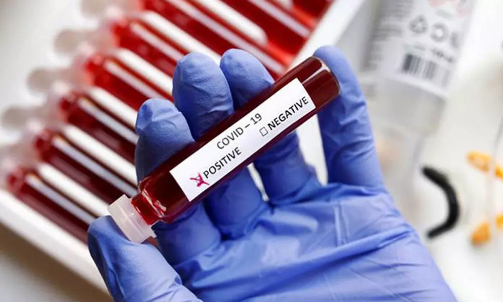 Tamil Nadu stays in high-risk mode, coronavirus cases touch 5,622