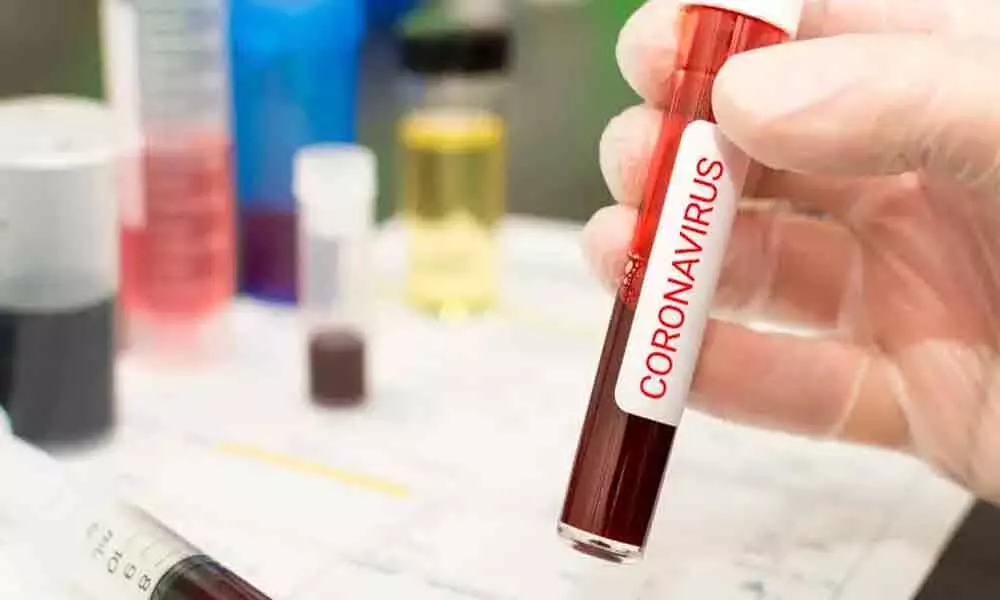 Blood test to predict high-risk Coronavirus patients