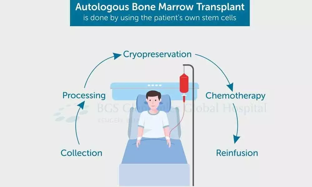 Rare double bone marrow transplant saves lives of two women patients