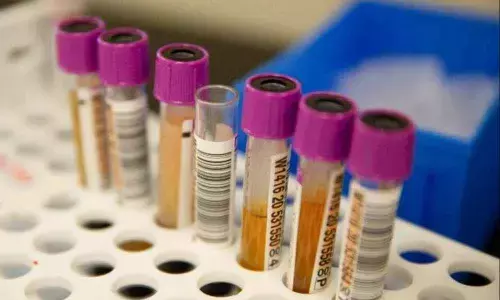 Syngene joins global consortium on Coronavirus testing research