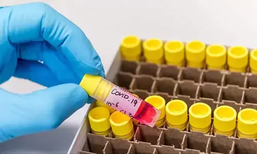 Sero survey finds 7.6 per cent exposed to corona in Chandigarh