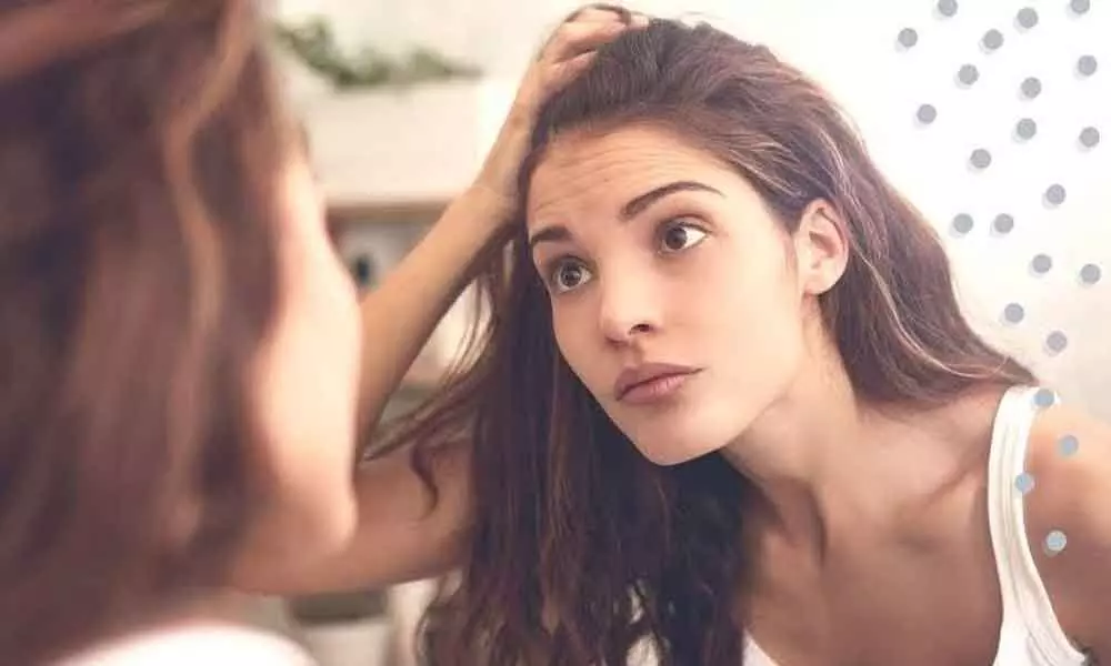 Home remedies to get rid of dandruff