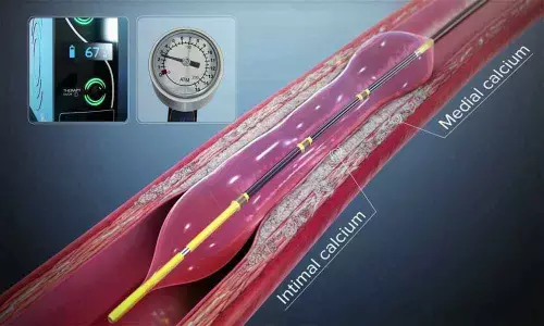 Armed forces veterans treated for high precision angioplasty at Manipal Hospitals using new tool