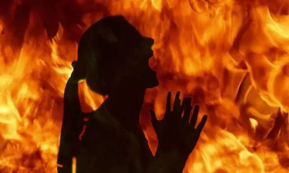 Woman set on fire by son, wife, his in-laws in UP