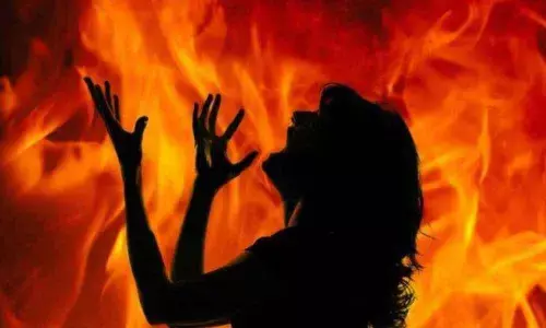 A 15-year-old Dalit girl was set ablaze in a village in Ballia district by a youth for spurning his sexual advances.