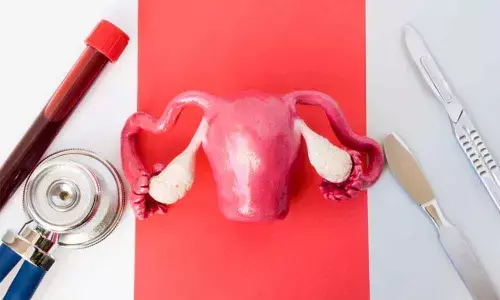 All you need to know about PCOS and its management