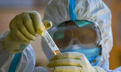 For representational purpose