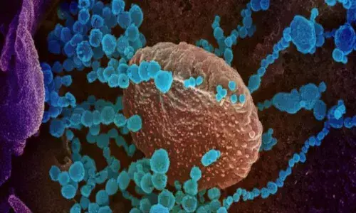 Stroke, altered mental state increase death risk for Coronavirus patients