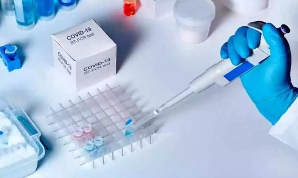 COVID-19: RT-PCR testing rates slashed from Rs 850 to Rs 500 in Telangana