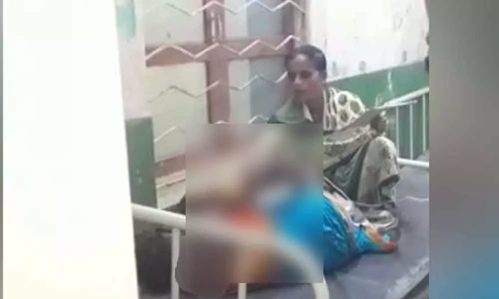 Woman injured in acid attack in Jagtial