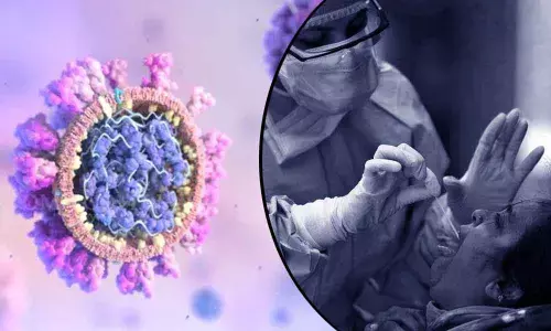 For representational purpose