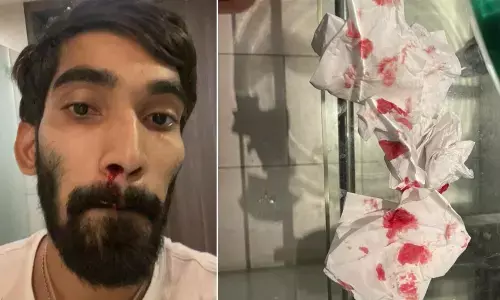 Srikanth left with bloodied nose after multiple Covid-19 tests