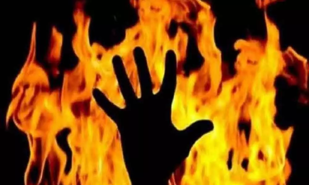 Man sets 10-year-old son ablaze for watching TV in Hyderabad