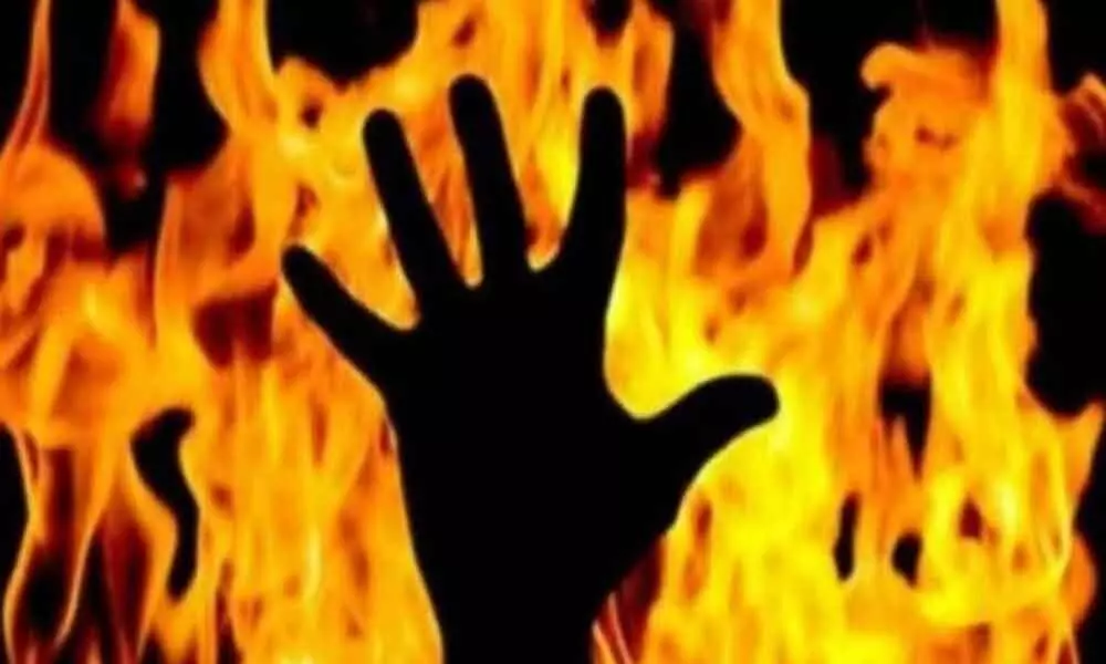 Hyderabad: 10-year-old Boy set ablaze by his father dies