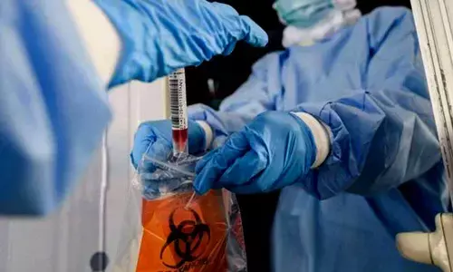 For representational purpose