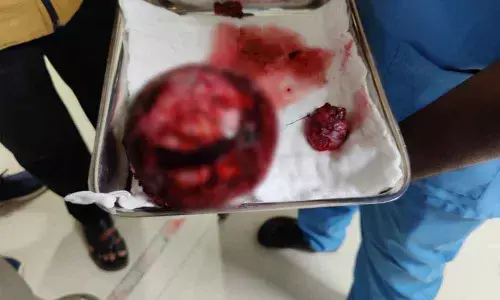 Prakriya doctors remove two tumours from liver of 73-yr-old woman weighing 36 kg