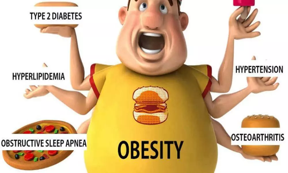 Obesity a very big problem now