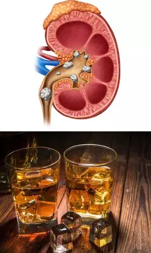 Kidney and Alcoholism