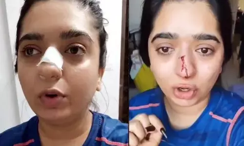 Zomato delivery executive mugged her, says Bengaluru model