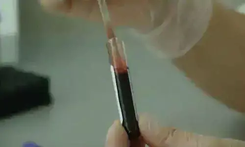 Bengaluru businessman turns life-saver by donating blood stem cells