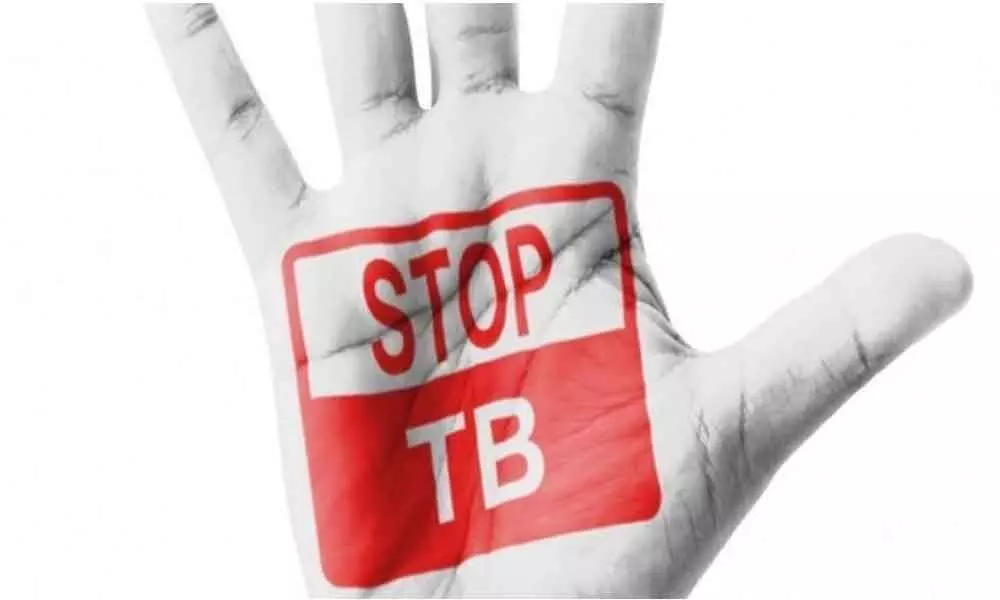 Professional bodies join hands to eliminate TB