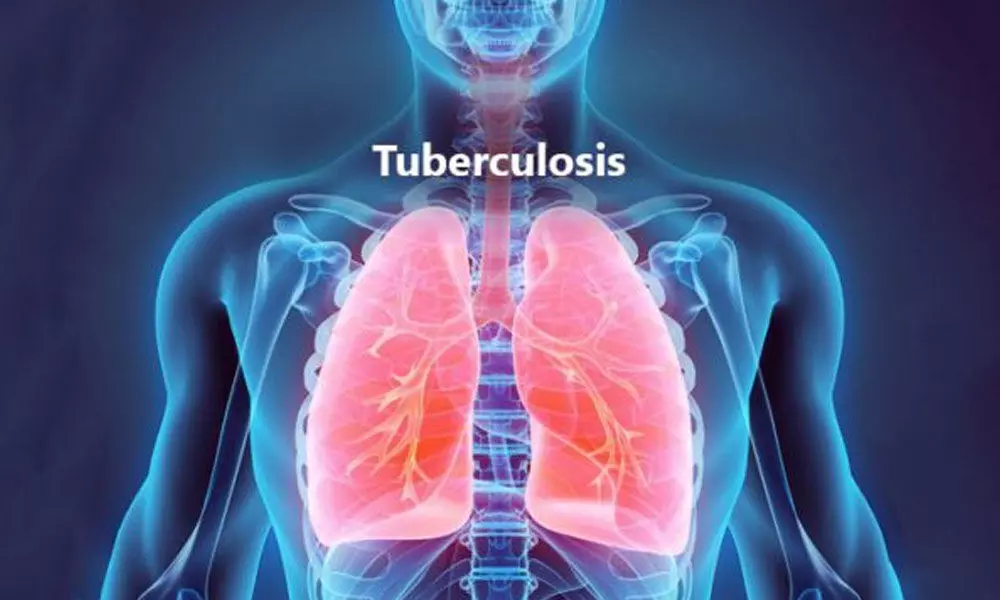 IISc researchers develop new, faster way to detect TB
