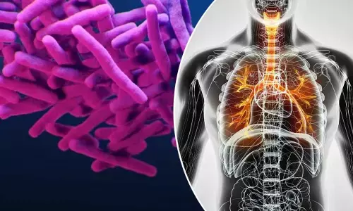 TB is World’s Deadly Infectious Disease –Good News is, it is Curable