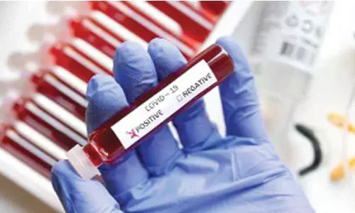 Alarming spread of Covid in East Godavari