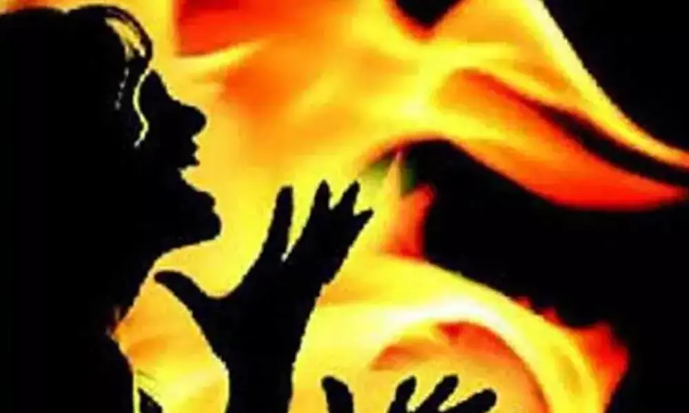 Woman security guard set ablaze by employer dies