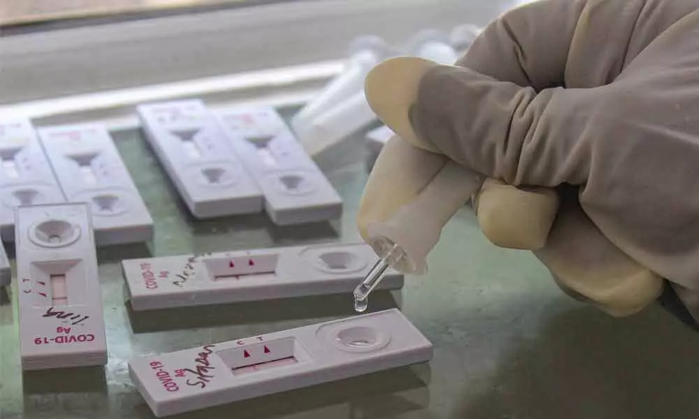 Telangana State running out of RT-PCR kits