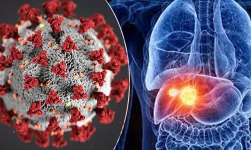 The impact of Covid-19 on your liver