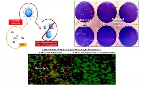 DCGI approves DRDOs anti-COVID drug for emergency use