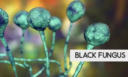 Rise of black fungus cause for concern