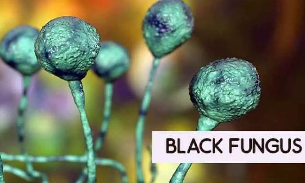 Nearly 200 cases of ‘black fungus’ in Delhi