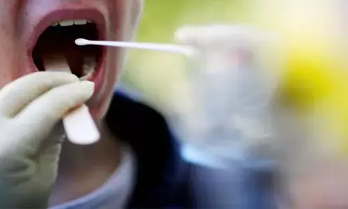 New symptom Covid Tongue sends citizens into a tizzy