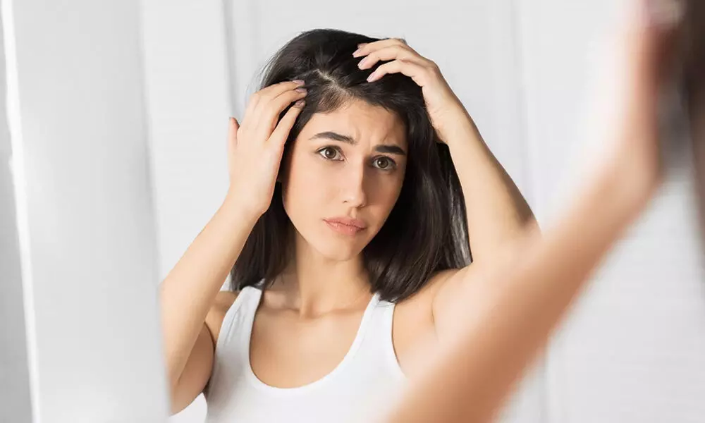 Simple hacks to avoid oily hair in summer